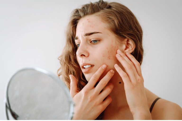 Woman looking at problematic skin in mirror.