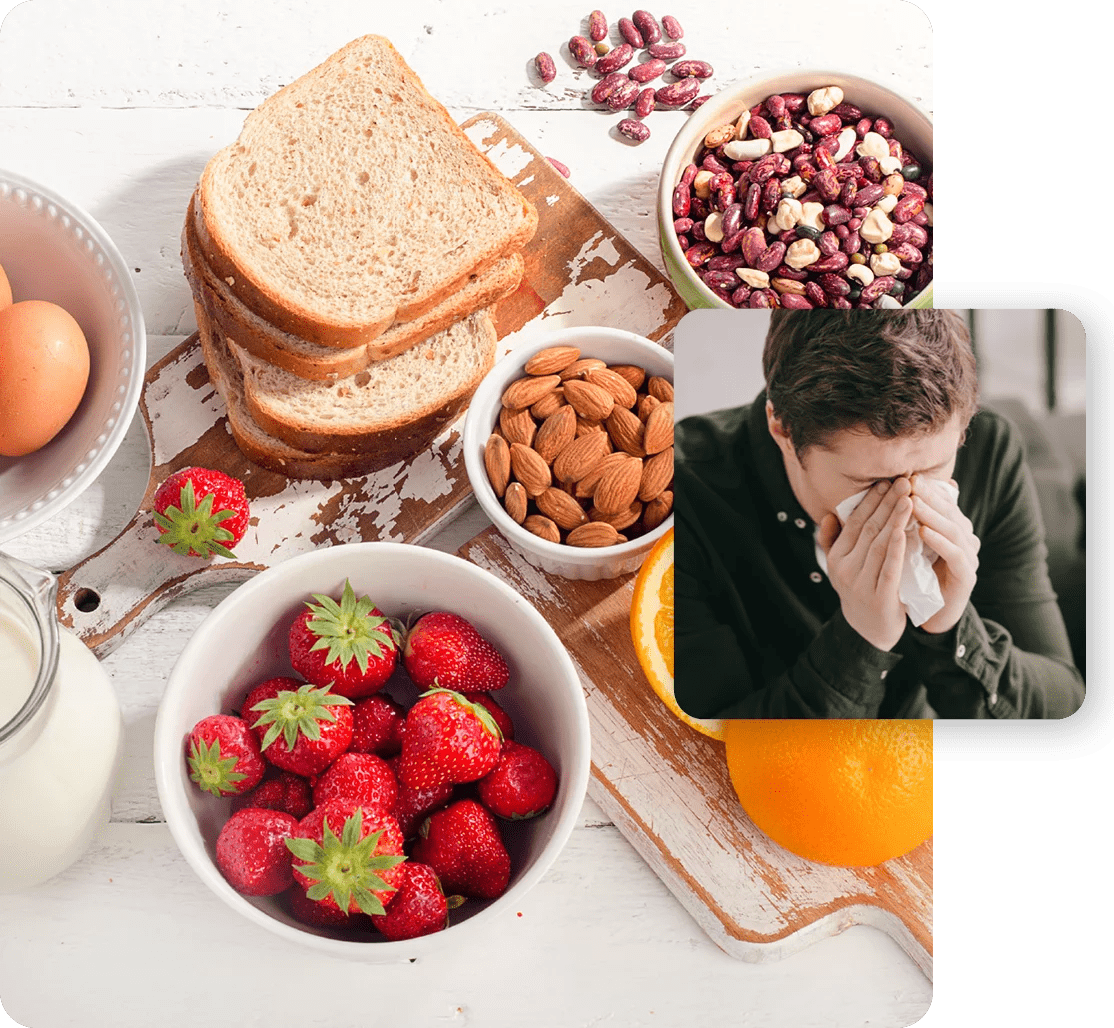 Allergie