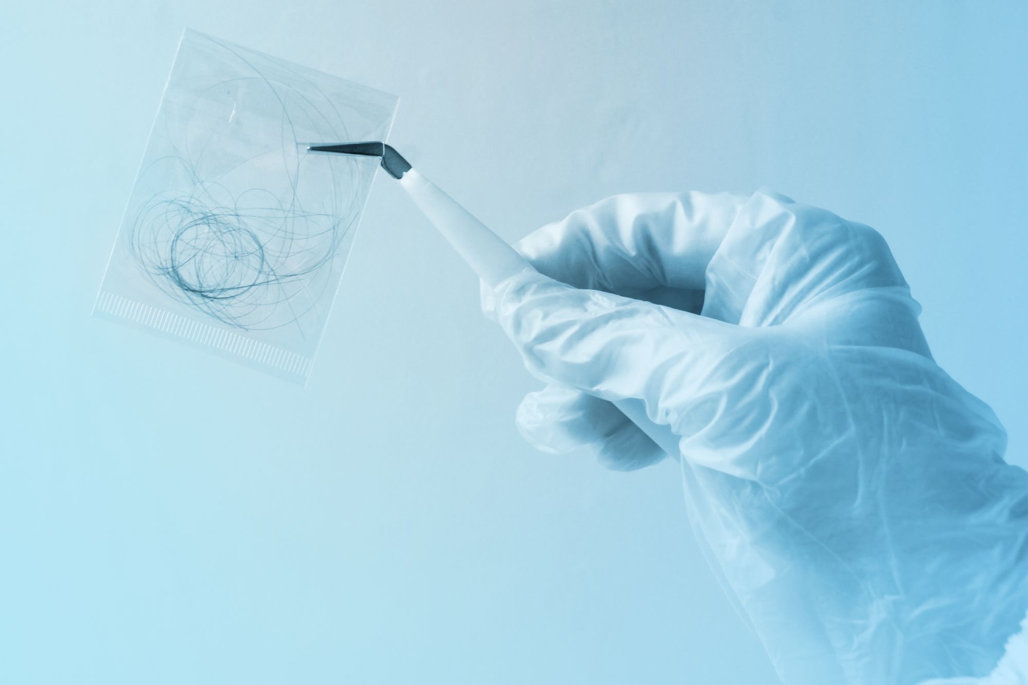 How Accurate Are Hair Tests for Food Sensitivities? Hair vs. Blood ...