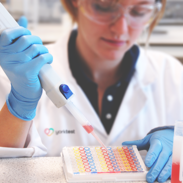 intolerance lab
