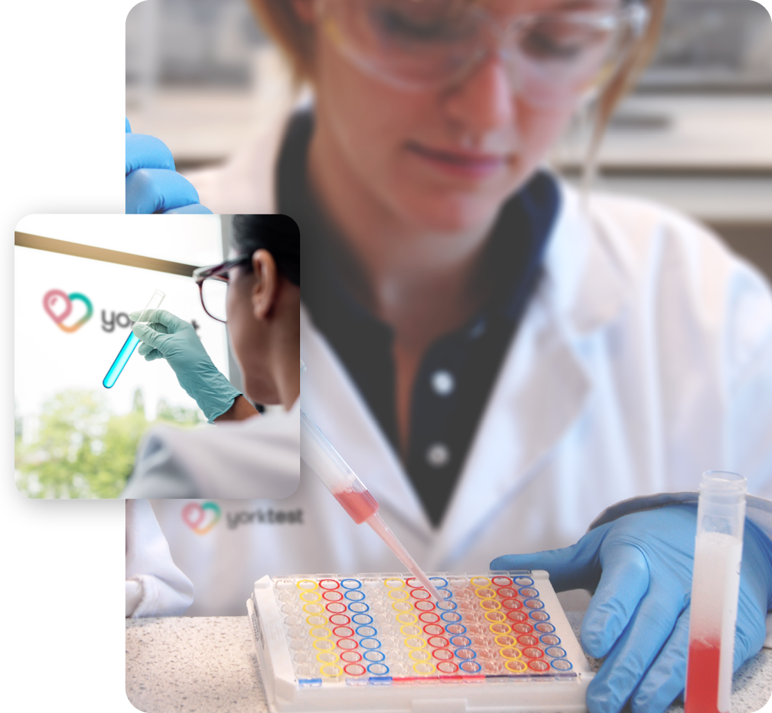 yorktest lab work