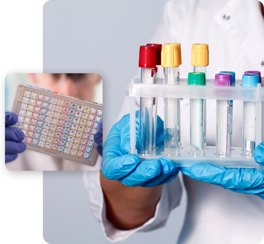 yorktest lab test tubes