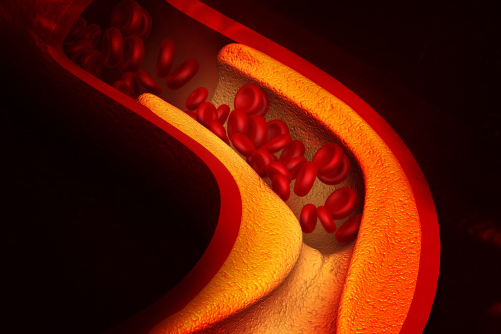 Why Get a Cholesterol Test? (The Only Way to Know Your Lipid Profile)